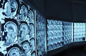 brain health and blood pressure