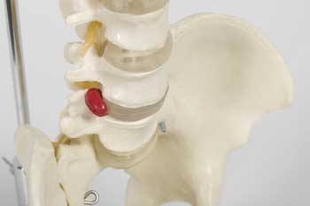 hip fractures and carotenoids