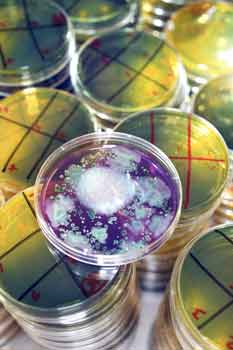 estrogen and urinary infections
